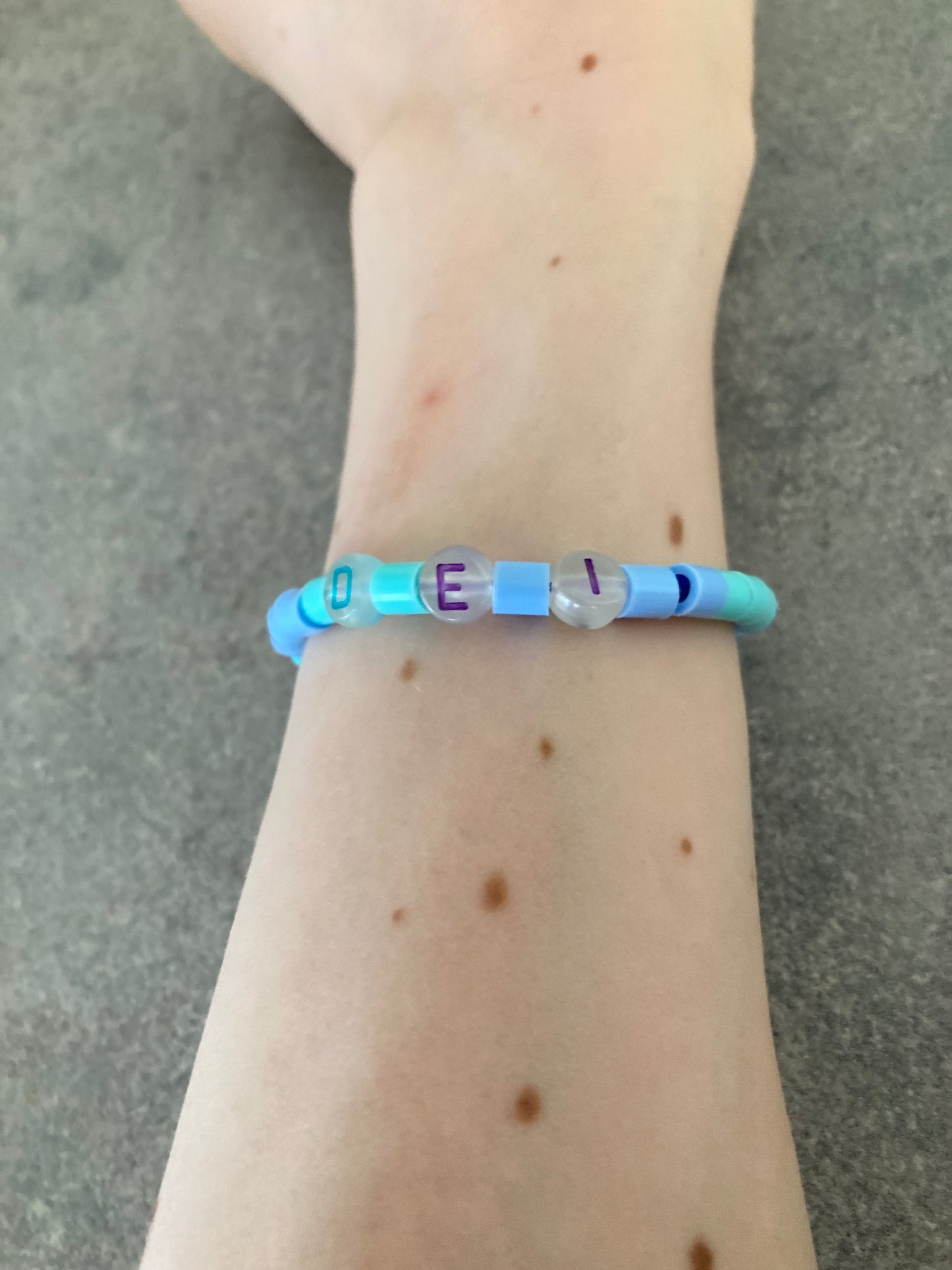 bracelet i.e.